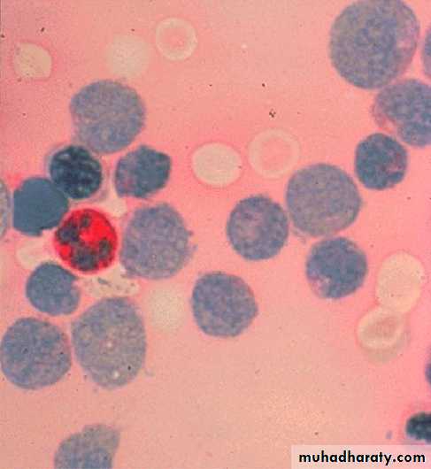 Hematopathology