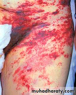 Hematopathology