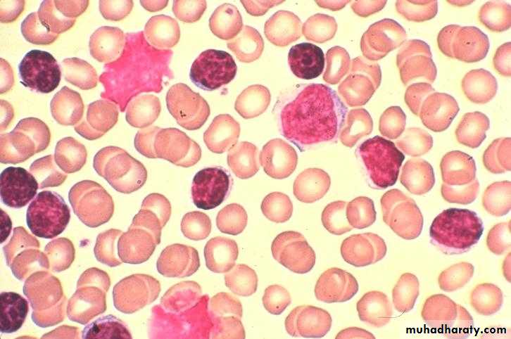 Hematopathology