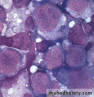 Hematopathology