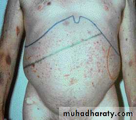 Hematopathology