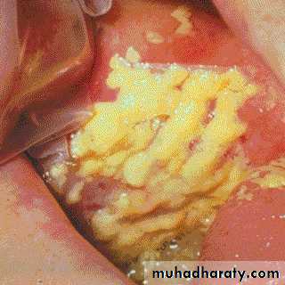 Hematopathology