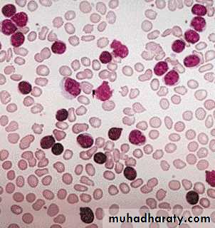 Hematopathology