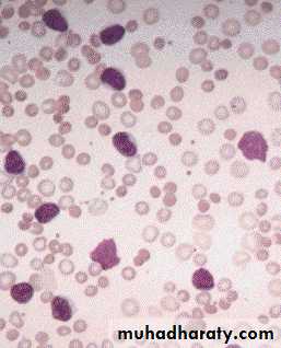Hematopathology