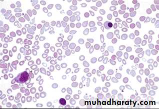 Hematopathology