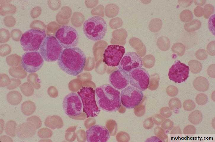 Hematopathology