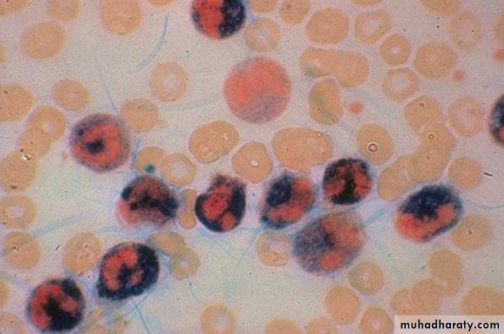 Hematopathology