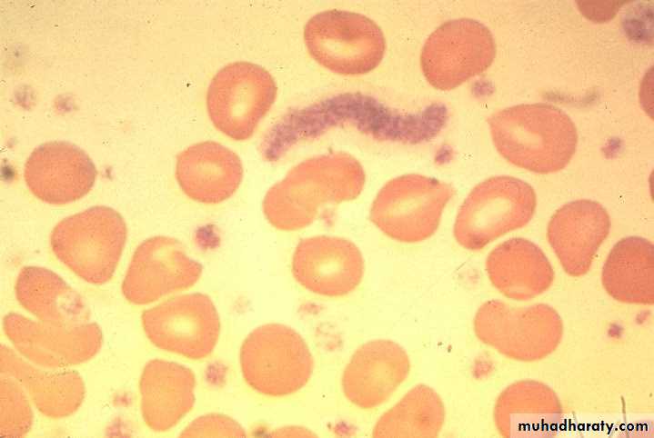 Hematopathology
