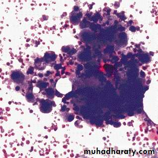 Hematopathology