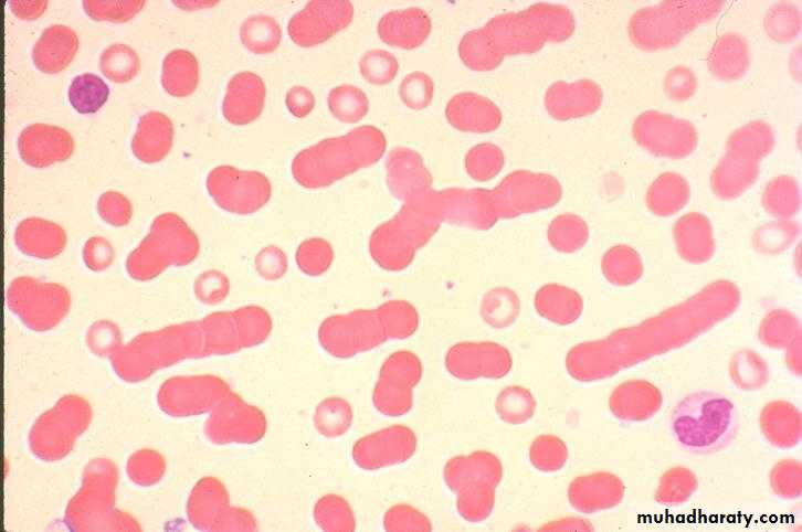 Hematopathology