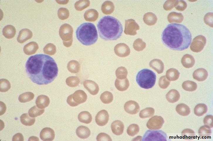 Hematopathology