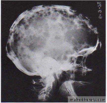 Hematopathology