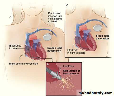 cardiovascular instrument and high frequency diathermy