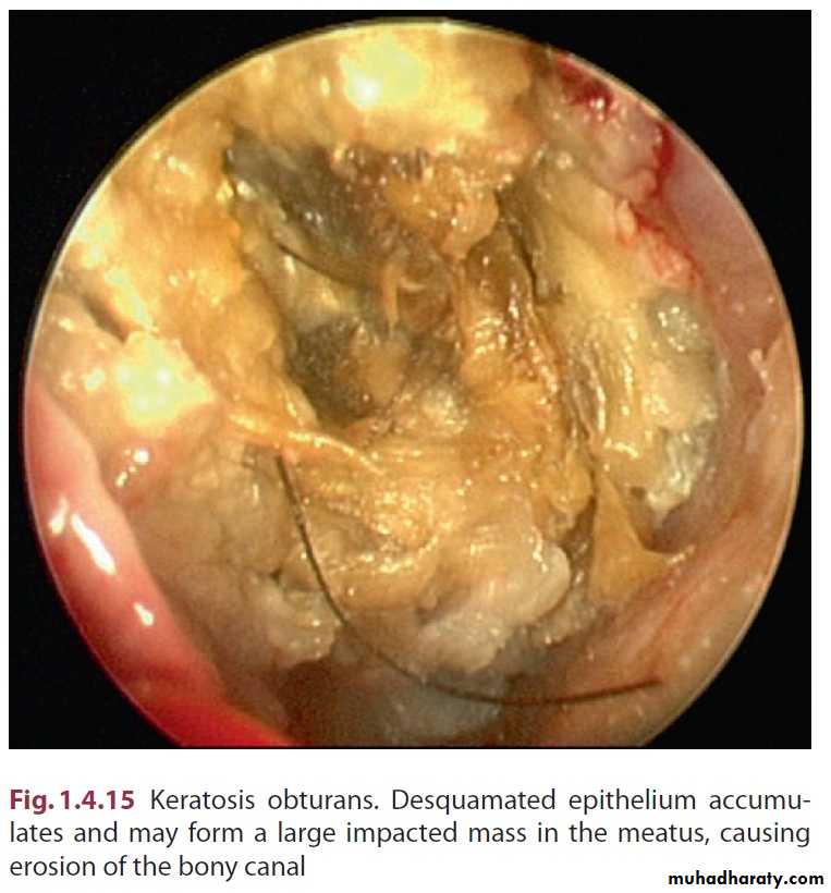 external and middle ear
