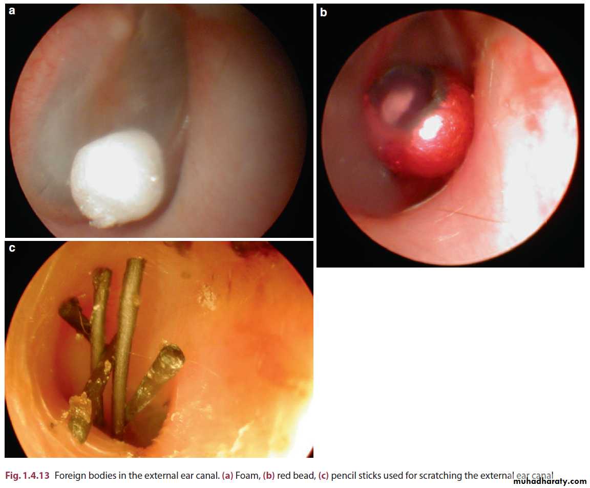 external and middle ear