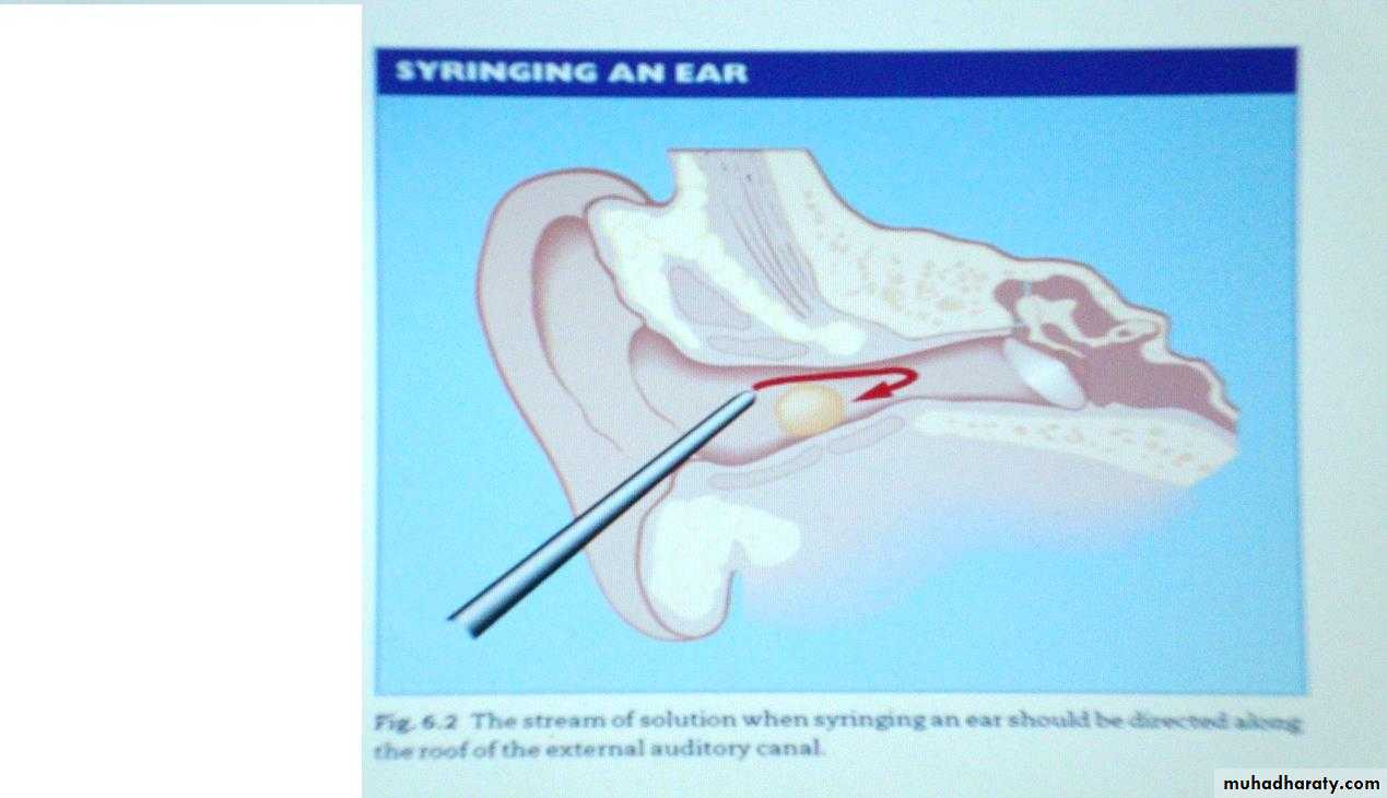 external and middle ear