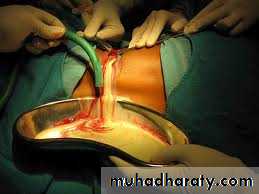 Peritoneum