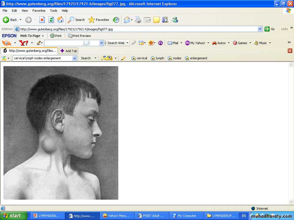 lymphatic diseases of the neck