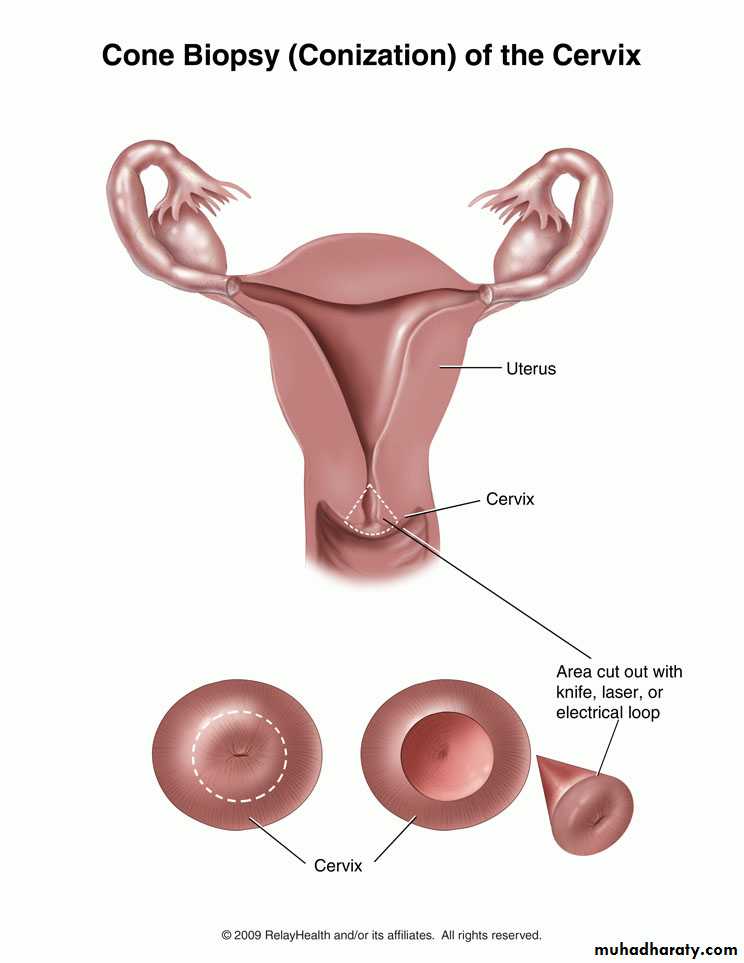operative gynecology