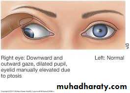 Cranial nerves