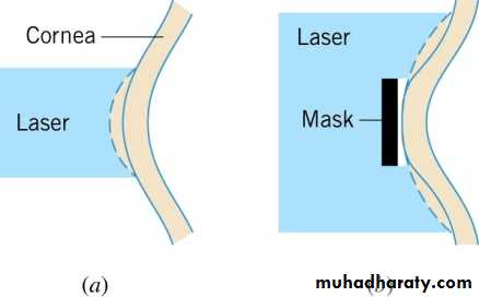 Laser means ppt