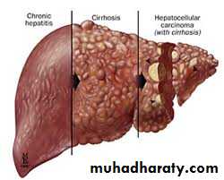 Viral Hepatitis