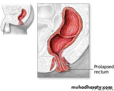 Diseases of large bowel