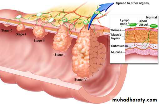Diseases of large bowel