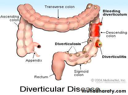 Diseases of large bowel