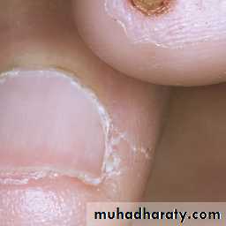 CTD