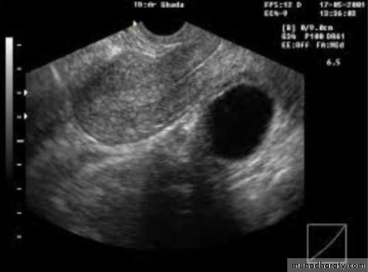 Slides of gynecology