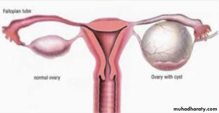 Slides of gynecology