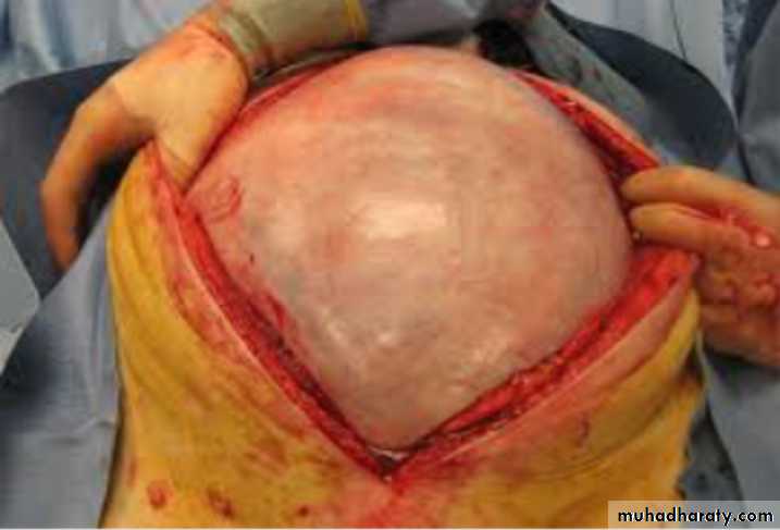 Slides of gynecology