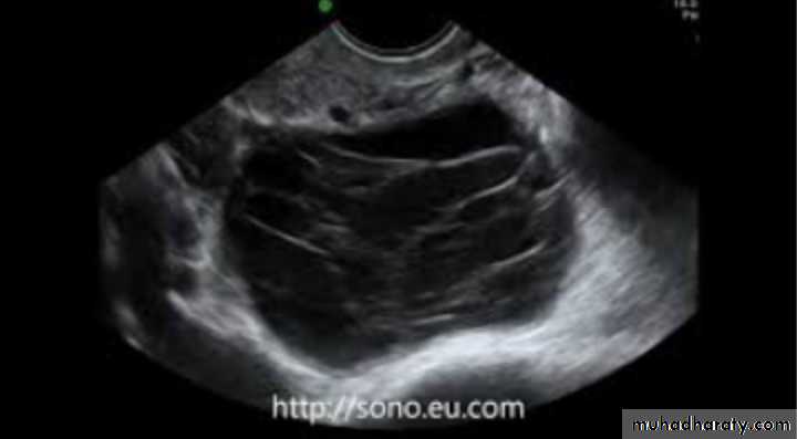 Slides of gynecology