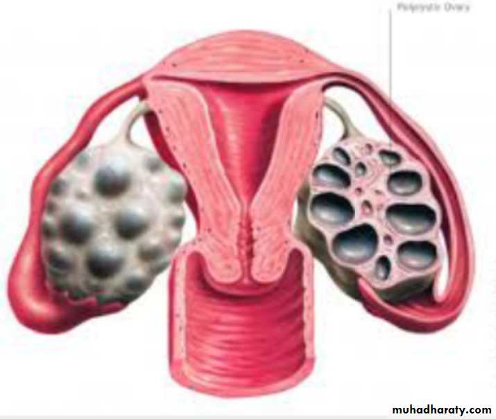 Slides of gynecology