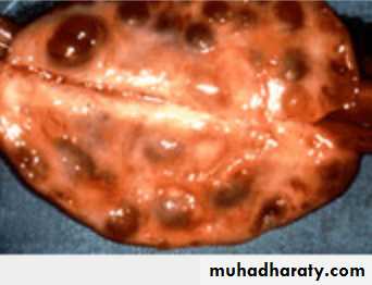 Slides of gynecology