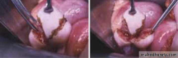 Slides of gynecology