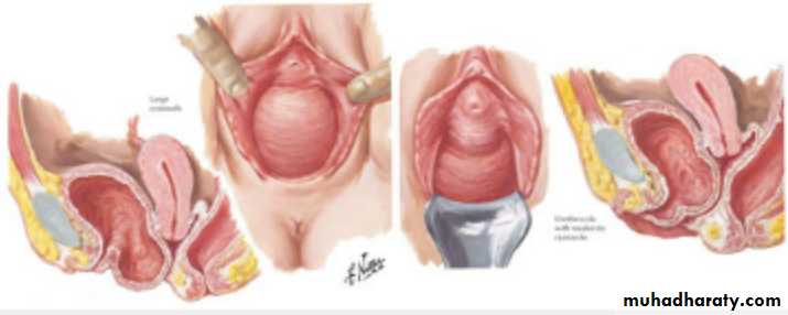 Slides of gynecology