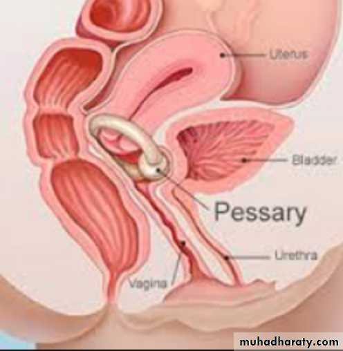 Slides of gynecology
