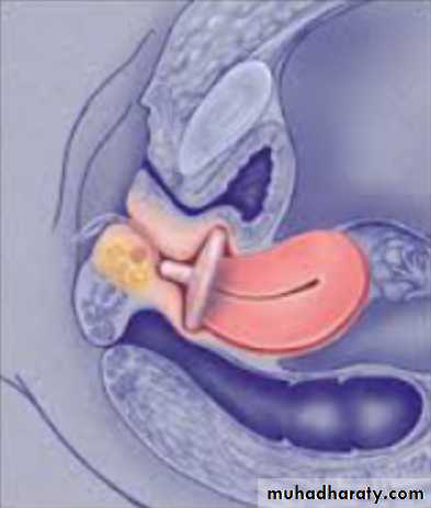 Slides of gynecology