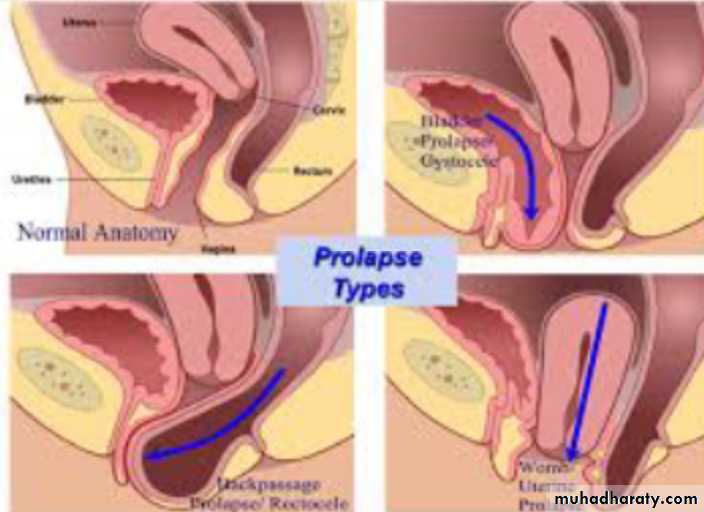 Slides of gynecology