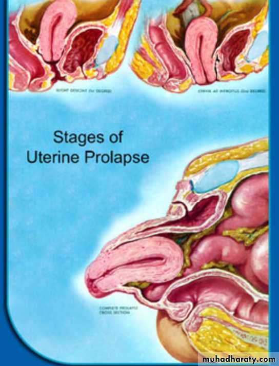 Slides of gynecology