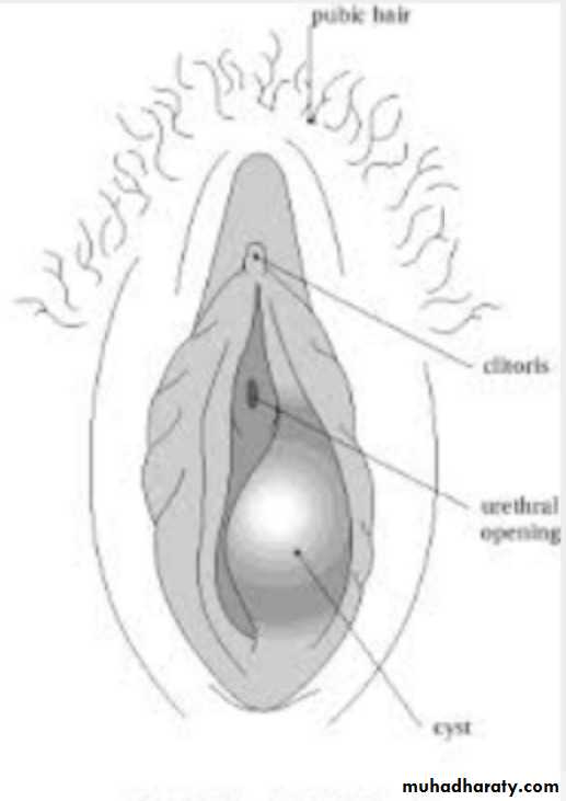Slides of gynecology