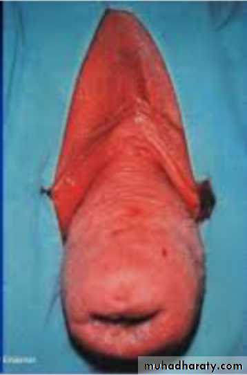 Slides of gynecology