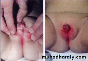 Slides of gynecology