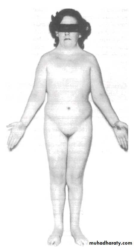 Slides of gynecology