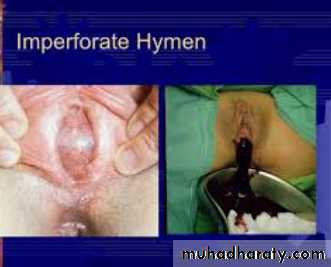 Slides of gynecology