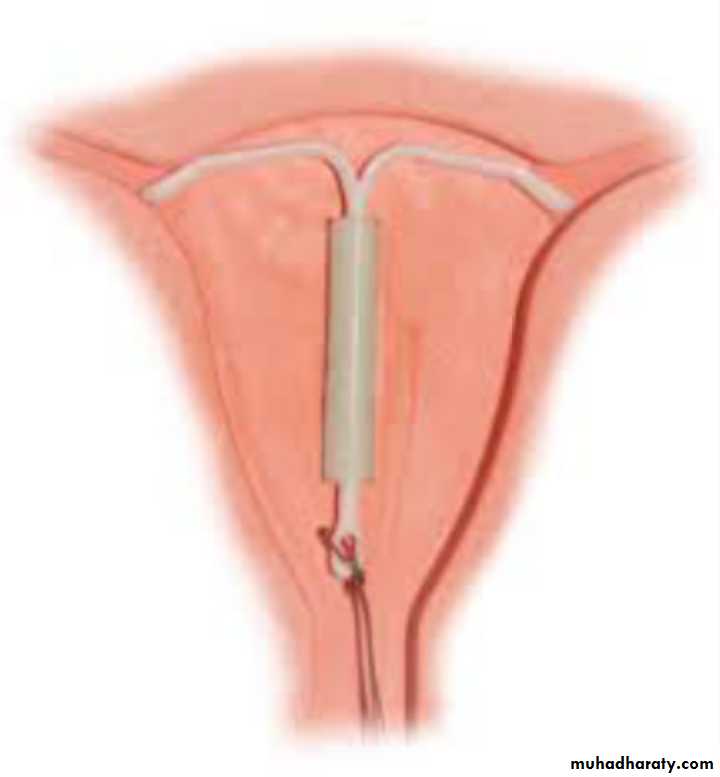 Slides of gynecology