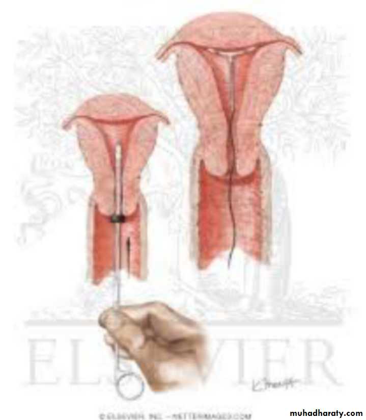Slides of gynecology
