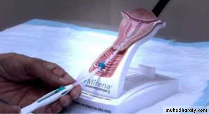 Slides of gynecology